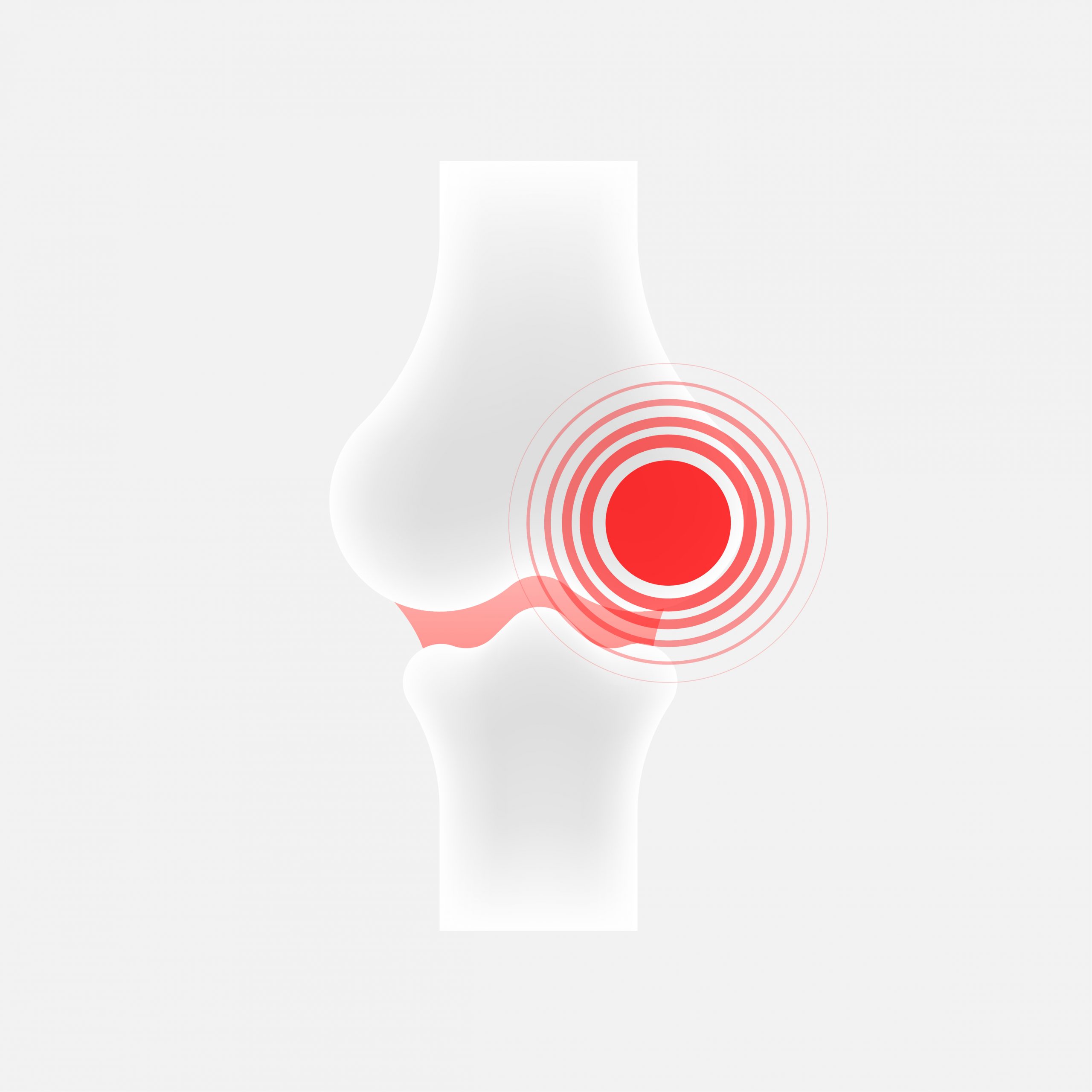 Infographic with joint pain. Human knee bone joint line icon